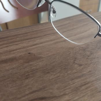 Ata Optik'in Gözlüğünün Vidalarının Aşırı Sıkılması Ve Yanlardan Ayrılması