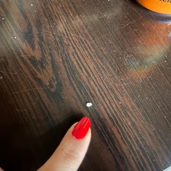 Burger King Menüsünde Taş Benzeri Yabancı Madde Ve Acil Şube Denetimi Talebi