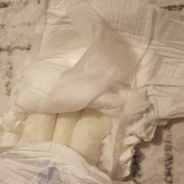 Molfix 5 Numaralı Bebek Bezinde İncelik Ve Kayma, Şiddetli Pişik Oluştu