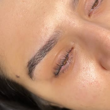 Sertifikasız Kirpik Lifting Sonrası Yapışma Ve Ücret İadesi Talebi