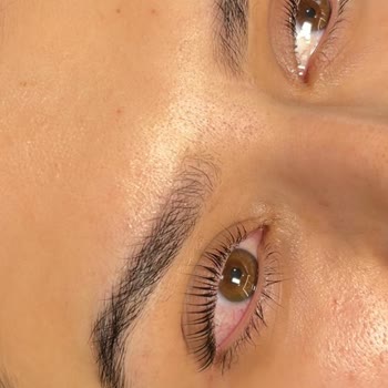 Sertifikasız Kirpik Lifting Sonrası Yapışma Ve Ücret İadesi Talebi