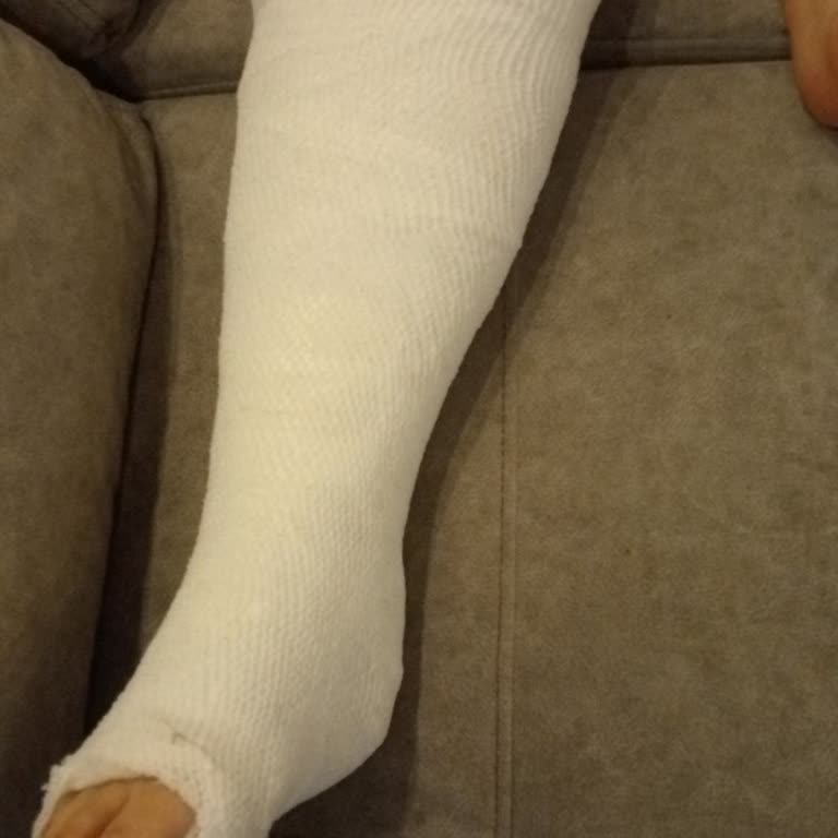 Kızımın Diz Ameliyatı Sonrası Yanlış Fizik Tedavi Ve Doktorun Saygısız Davranışı