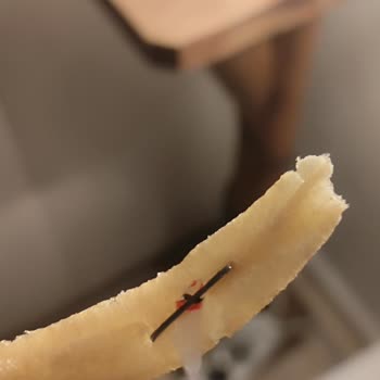 Patates Kızartmasında Bulunan Zımba Teli Sağlık Ve Güvenlik Sorunu