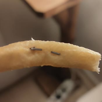 Patates Kızartmasında Bulunan Zımba Teli Sağlık Ve Güvenlik Sorunu