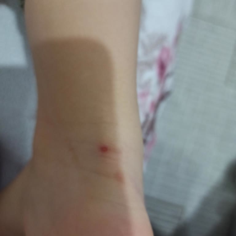 Decathlon Yüzme Paleti Topuk Yarası Ürün Değişimi Veya Ücret İadesi Talebi