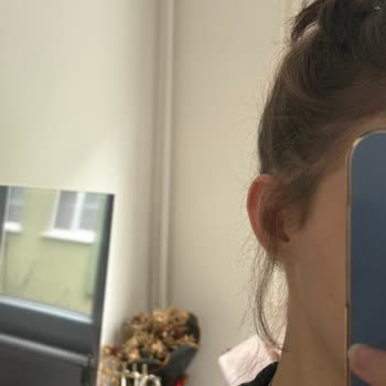 Salon Avrupa Yapılan İşlemin Sonucunda Saçlarım Resmen Mahvoldu