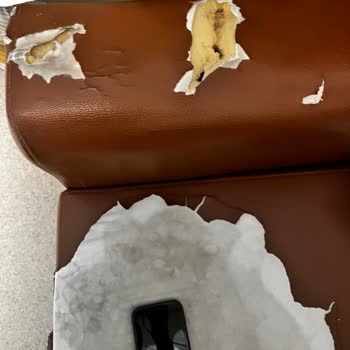 Refakatçi Koltuğu Hijyen Ve Konfor Eksikliği Personel Umursamazlığı