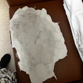 Refakatçi Koltuğu Hijyen Ve Konfor Eksikliği Personel Umursamazlığı