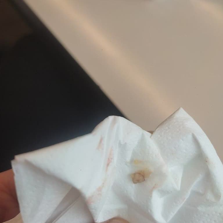 İçli Köfte İçinde Yabancı Cisim Bulunması Hijyen Ve Gıda Güvenliği İhlali