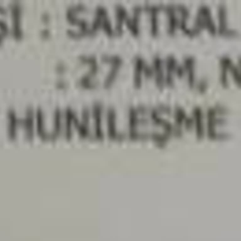 Hisar Hospital Çamlıca Yanıltıcı Ultrason Bilgileriyle Eşimin Psikolojisini Altüst Eden Doktor