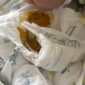 Prima Premium Care 2 Numaralı Bebek Bezinde Sızdırma Ve Kaka Taşması