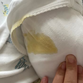 Prima Premium Care 2 Numaralı Bebek Bezinde Sızdırma Ve Kaka Taşması