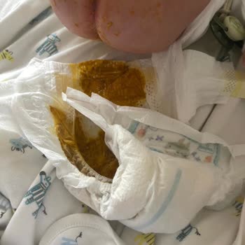 Prima Premium Care 2 Numaralı Bebek Bezinde Sızdırma Ve Kaka Taşması