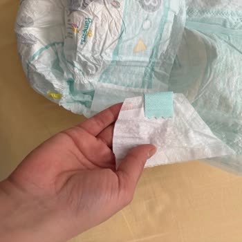 Prima 8 Numaralı Aktif Bebek Bezlerinde Cırt Sorunu