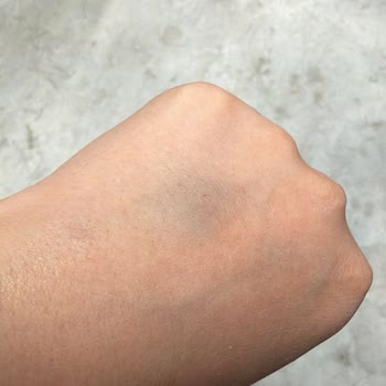 Medicana Sağlık Grubu Hemşire İki Kolda Damar Yolu Açamayıp Şiddetli Ağrıya Sebep Oldu!