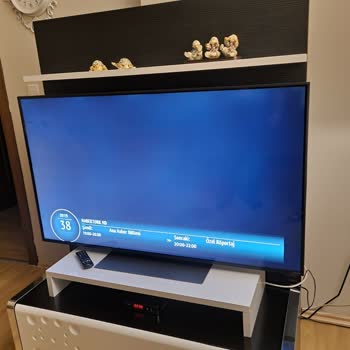 LG Televizyonda Ekran Işık Sızması Ve Yetersiz Servis Yanıtı