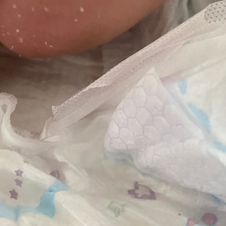 Molfix Comfy 3 Bebekte Kristal Parçacıklar Ve Cilt Tahrişi