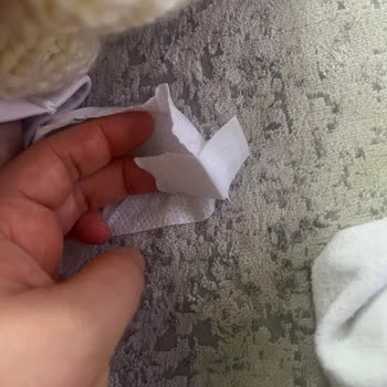 Molfix Ultra Bebek Bezlerinde Cırtlı Kısımların Yapışmaması Ve Ücret İadesi Talebi