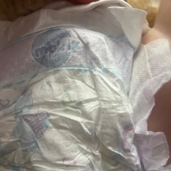 Molfix Ultra Bebek Bezlerinde Cırtlı Kısımların Yapışmaması Ve Ücret İadesi Talebi