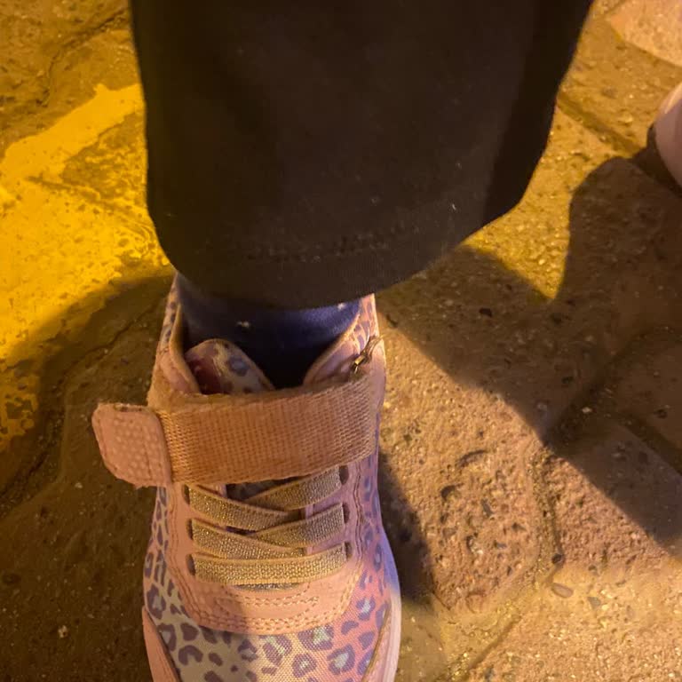 Ortopedik Çocuk Ayakkabısının Dili Kayıyor, Mağaza Değişim İadesini Reddetti