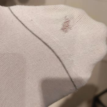 Beyaz Çoraplar İlk Kullanımda Eridi, Mağaza Değişim Reddetti