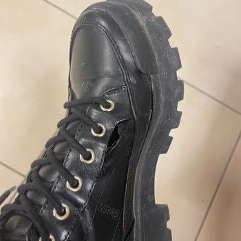 Ayakkabı Dikişleri Patladı Ve Ayak Sağlığında Ciddi Risk Oluşturdu