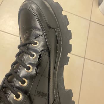 Ayakkabı Dikişleri Patladı Ve Ayak Sağlığında Ciddi Risk Oluşturdu