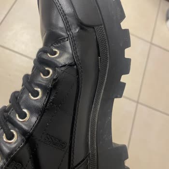 Ayakkabı Dikişleri Patladı Ve Ayak Sağlığında Ciddi Risk Oluşturdu