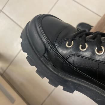 Ayakkabı Dikişleri Patladı Ve Ayak Sağlığında Ciddi Risk Oluşturdu