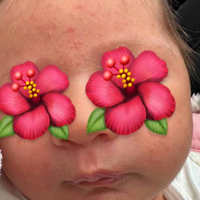 Mustela Yenidoğan Şampuanının Cilt Reaksiyonu Ve Ücret İadesi Talebi