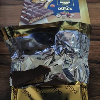 Çikolata İçinde Fındık Kabuğu Parçası Dişine Zarar Verdi