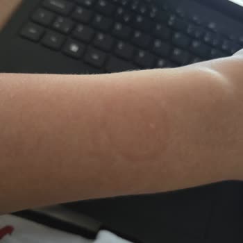 Silikon Kordon Alerjisi Huawei Redmi Watch 3 Modeli Kullanılamaz Hale Getiriyor