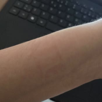 Silikon Kordon Alerjisi Huawei Redmi Watch 3 Modeli Kullanılamaz Hale Getiriyor