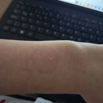 Silikon Kordon Alerjisi Huawei Redmi Watch 3 Modeli Kullanılamaz Hale Getiriyor