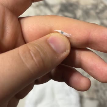 Bebek Bezinde Sert Siyah Parça Bulunması Güvenimi Sarsıyor