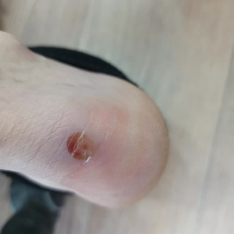 Ayakkabı Ayağımı Yarıyor, Mağaza Değişim Ve İade Talebimi Reddetti