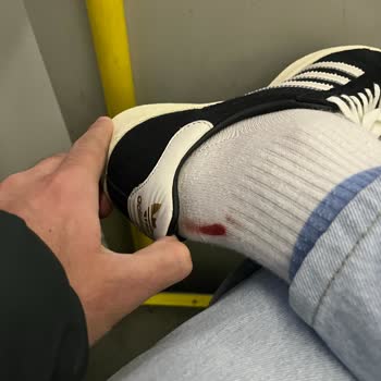 Ayıplı Spor Ayakkabı Nedeniyle Ayağımda Yara Oluştu: İade Ve Değişim Talebi