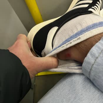 Ayıplı Spor Ayakkabı Nedeniyle Ayağımda Yara Oluştu: İade Ve Değişim Talebi