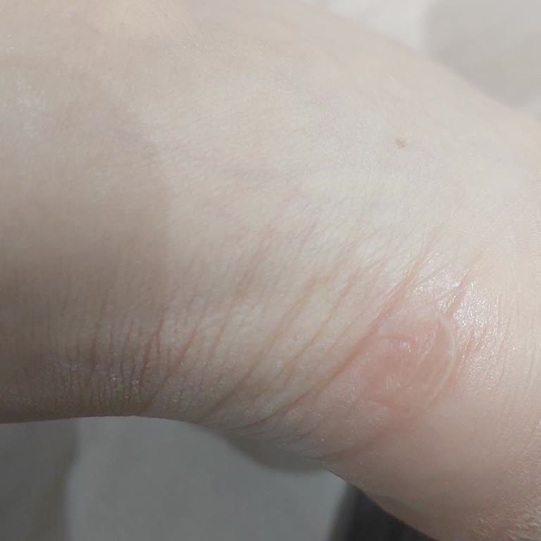 Lumberjack Ayakkabısının Topuk Sancı Ve Mağaza Çözüm Yetersizliği