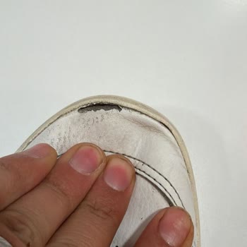 Boyner Mağazasında Ayıplı Adidas Ayakkabının Garanti Redleri Ve Müşteri Hizmetleri İhmali