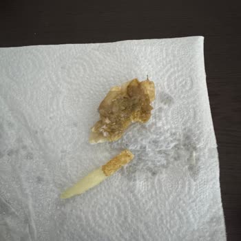 Burger King'de Çürük Marul ve Pişmemiş Patates: Sağlık Riski Ve Hizmet Şikayeti