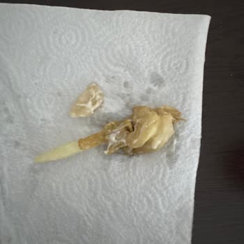 Burger King'de Çürük Marul ve Pişmemiş Patates: Sağlık Riski Ve Hizmet Şikayeti