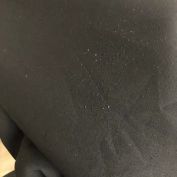 HR Butiğinden Aldığım Takımın Pantolonu Tüylenerek Kullanılamaz Hale Geldi Ve Markanın İlgisizliği