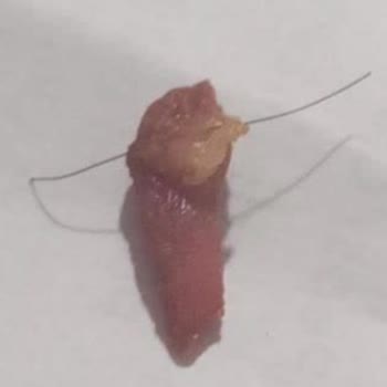 Kıl Çıkan Tavuk Ve Bozuk Tatlı Nedeniyle İade Reddi