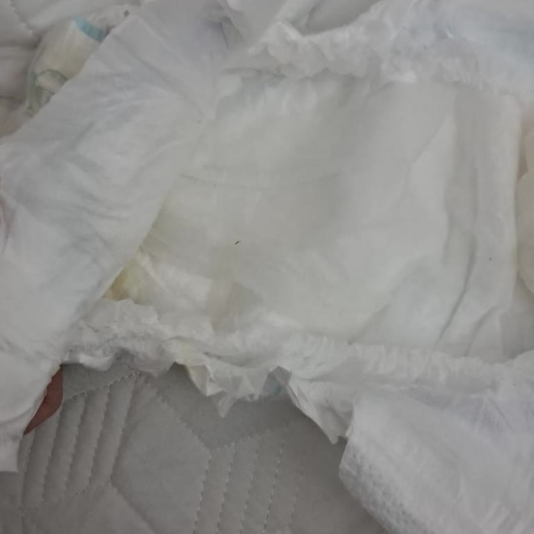 Molfix Junior Bebek Bezi Üst Tabakası Yırtılıyor, Kristaller Cilde Yapışıyor: Sağlık Riski