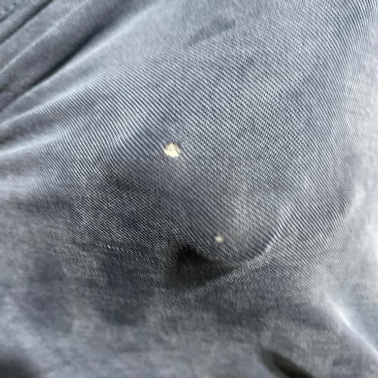 Defolu Takımda Gizli Broş İğnesi Kusuru Ve Kullanıcı Hatası İddiası