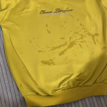 Philips Aldığım Ütüde Tekrarlayan Su Sızıntısı Ve Değişim Gecikmesi