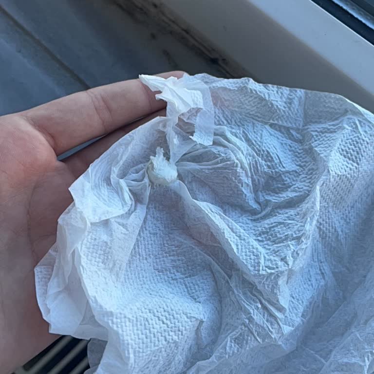 Burger King Dudullu Şubesinde Peçetelerde Sakız Çıktı Ve Hijyen Endişesi