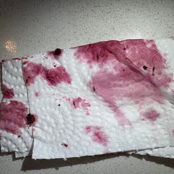 Migros Lavi Orman Meyvesi Ürününde Kurtlar Çıktı