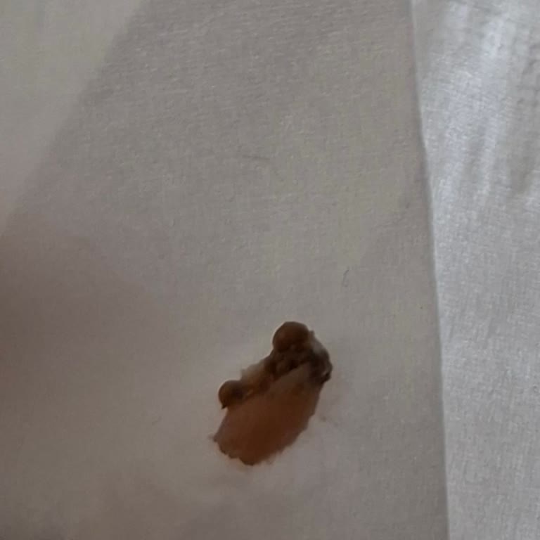 Mis Marka Kefirinde Yabancı Madde Bulunması Gıda Güvenliği Endişesi